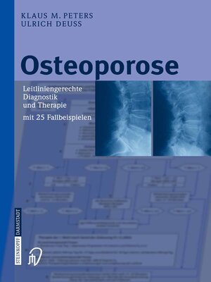 cover image of Osteoporose